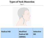 Neck, Thyroid, Breast, Venous Disorders Flashcards