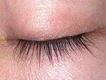 Eyelids