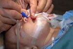 Plastic Surgery