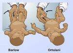 Paediatric orthopaedics - Basics, SCFE, DDH, CTEV, Achondroplasia