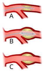 Vascular Surgery