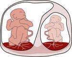 Placenta and Twin Pregnancy
