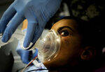 Pre-Anesthetic Checkup and Intra-Op Monitoring