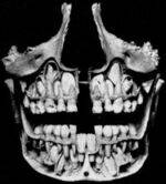 Dentition, Dactylography, Palatoscopy