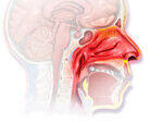 Rhinitis, CSF Rhinorrhea, Epistaxis