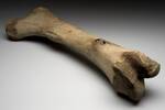 Bone basics, Fracture - Healing and Abnormal outcomes