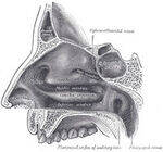 Sinuses, Acute and Chronic Rhinosinusitis