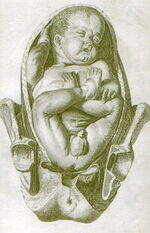 Abnormal Labour - Breech, OP, External cephalic version, AMTSL