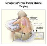 Anatomy Flashcards 4 - Circulation, Thorax, Abdomen, Lower limb