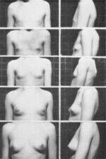 Puberty, Primary and Secondary Amenorrhea
