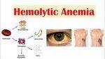 Hyperproliferative Anemia - Hemolytic anemias, AIHA, Coombs Test, PNH, HUS, TTP