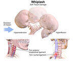 Thoracic Trauma, Head and Neck Trauma