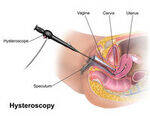 Gynecology