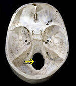 Development, Osteology, Foramen, Neurovascular Structures