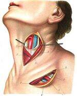 Thyroid Examination, Scores, Goitre, Surgeries