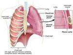 Classification, Respiratory Falilure, Spirometry, DLCO, Pleura