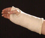 Elbow, Forearm, Carpal bones, Hand
