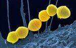 GP Cocci - Strep
