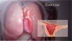 Pulmonary Thromboembolism, Hypertension, ILD, Occupational lung diseases