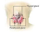 Thyroiditis and Parathyroid