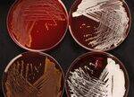 GP Bacilli - Actinomyces, Nocardia, Diphtheria, Bacillus, Listeria