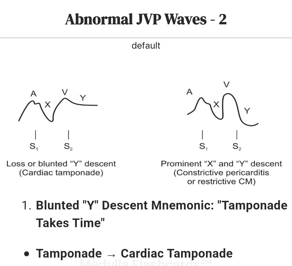 Medicine ECG, JVP Flashcards