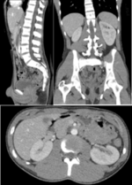 Genitourinary Radiology and Renal Tumors