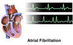 Pulse, JVP, Heart Sounds