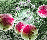 Paraneoplastic Syndrome, Carcinogens, Special Neoplasms