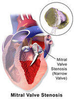 Valvular Disorders - AS, AR, MS, MR