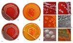 GN Bacilli - Vibrio, Pseudmonas, Bacteroids