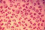 GN Diplococci - Neisseria, Moraxella