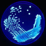 GN Coccobacilli - Acinetobacter, Bordetella, Brucella, H. influenza, Mycoplasma, Legionella, Chlamydia