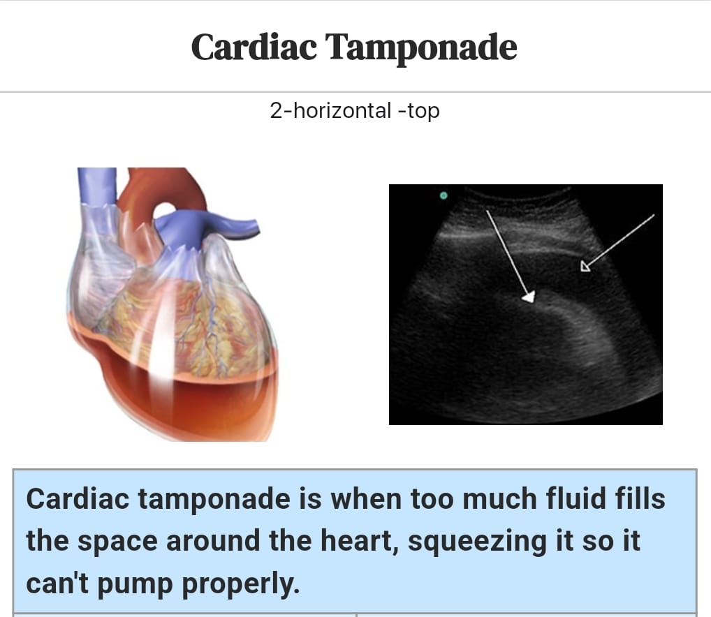 Medicine Cardiovascular System Flashcards