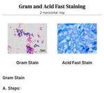 Microbiology Flashcards 1 : Bacteriology, Culture media