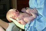 Classification, Neonatal Reflexes, Resuscitation, APGAR