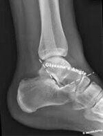 Knee, Foot and Ankle