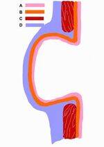 Esophageal diverticulum, hernia, Perforation, Motility disorders