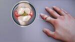 Rheumatology