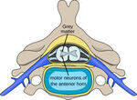 Headache, Motor Neuron Disease - GBS, MG, LEMS, ALS