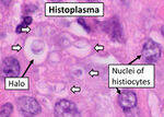 Opportunistic and Dimorphic fungi - Candida, Aspergillus, Mucor, PCP, Cryptococcus, Sporothrix, Histoplasma