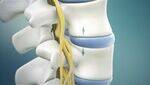 Spinal cord - Compressive and Non-Compressive myelopathy