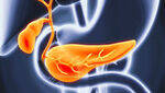 Endocrine and Exocrine Pancreatic Tx, Cystic Pancreatic Neoplasms
