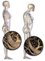 Metabolic bone disorders