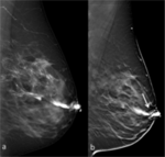 Breast, Obstetrics and Gynecology imaging