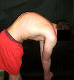 Calcium homeostasis, Rickets, Osteomalacia, Scurvy, HyperPTH, Renal Osteodystrophy