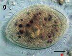 Entamoeba, Amoeba, Giardia, Trichomonas, Trypanosoma, Leishmaniasis, B. coli