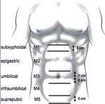 EHS Classification, Femoral, Ventral, Named hernias, Omphalocele, Gastrochisis, CDH