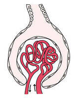 Nephrotic Syndrome, AKI, Potassium Disorder