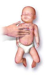 Respiratory
